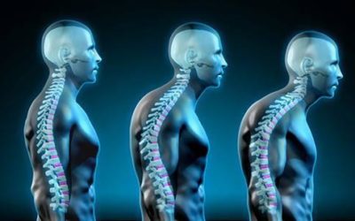 How Computer Work Damages Your Body